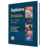 Implantes Dentales. Arte y Ciencia. 2 Edición