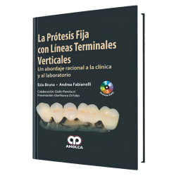 La Prótesis Fija con Líneas Terminales Verticales