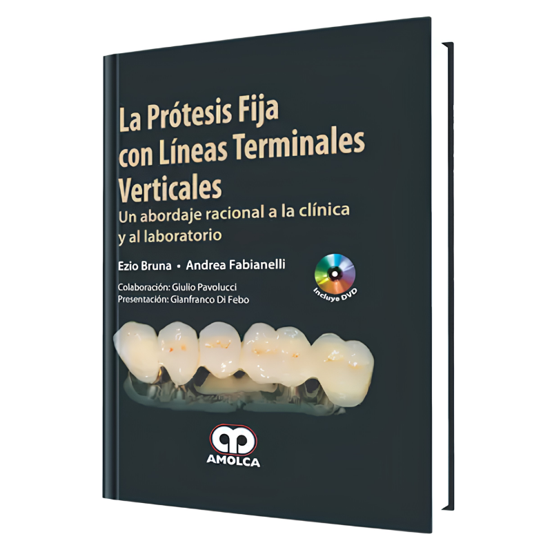 Fixed prosthesis with vertical terminal lines