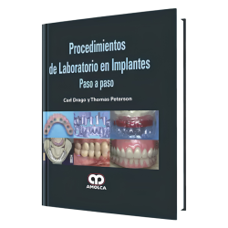 Procedimientos de Laboratorio en Implantes Paso a Paso.