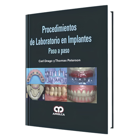 Procedimientos de Laboratorio en Implantes Paso a Paso.
