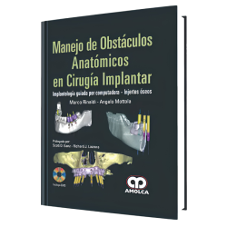 Manejo de Obstáculos Anatómicos en Cirugía Implantar