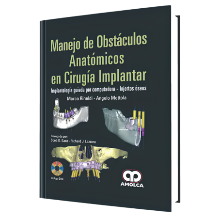 Management of anatomical obstacles in surgery Implant