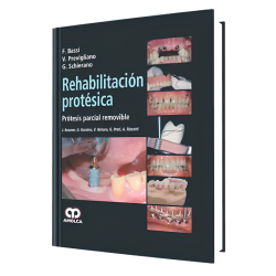 Rehabilitación Protésica. Prótesis Parcial Removible