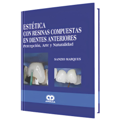 Estética con Resinas Compuestas en Dientes Anteriores