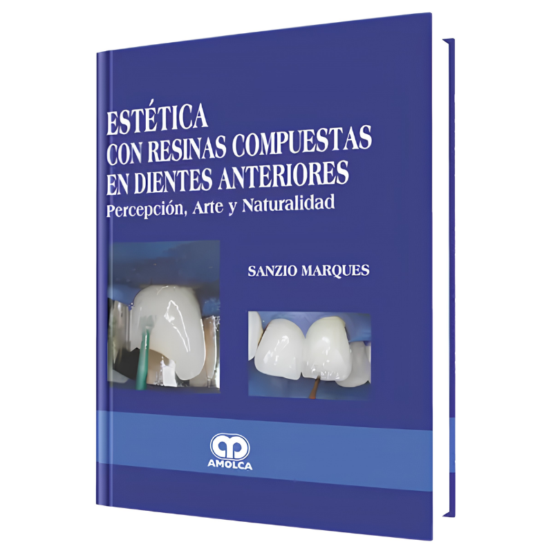 Estética con Resinas Compuestas en Dientes Anteriores