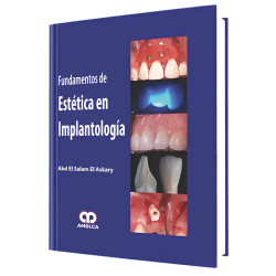 Fundamentos de Estética en Implantología