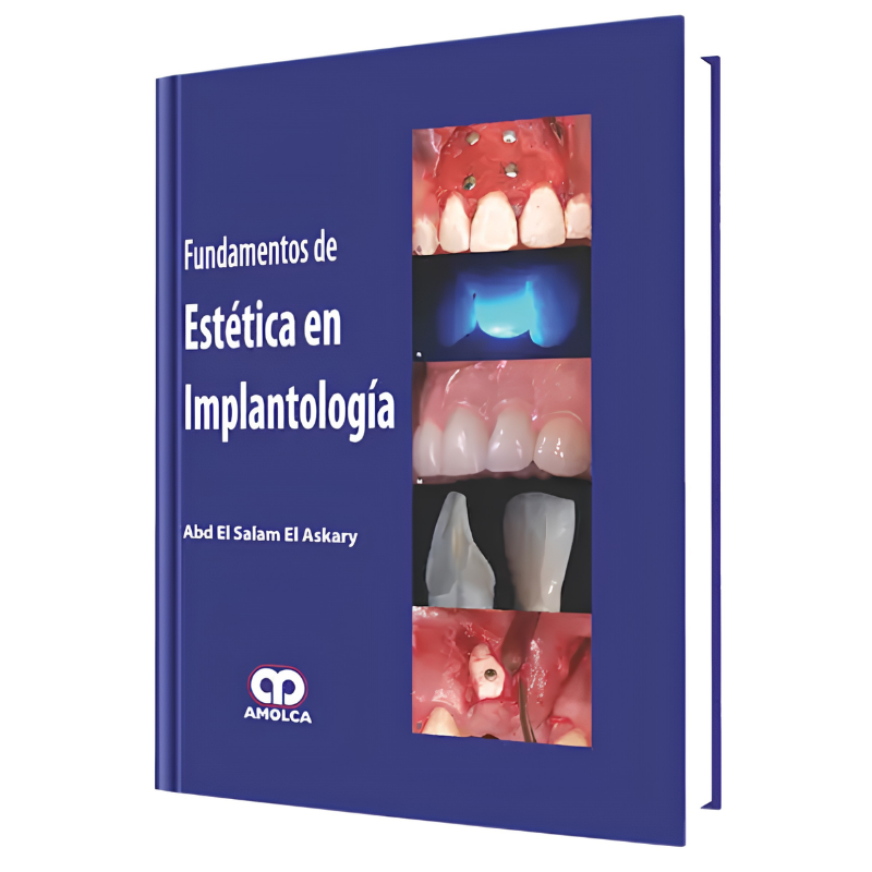 Fundamentals of aesthetics in Implantology