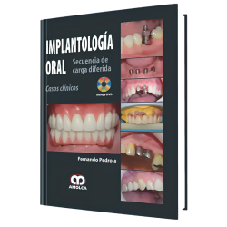 Implantología Oral