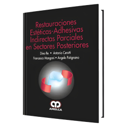 Partial indirect aesthetic restorations in later sectors