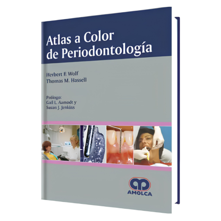 Atlas a Color de Periodontología