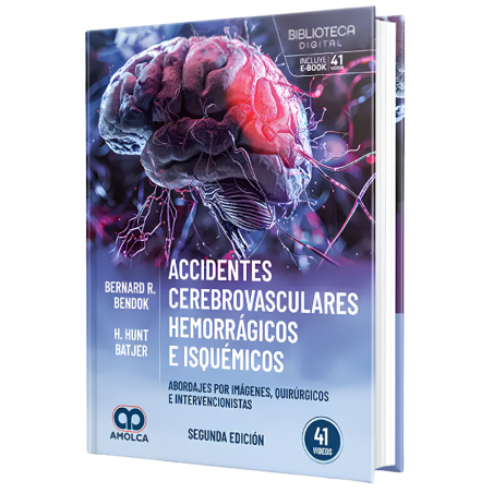 Hemorrhagic and ischemic strokes. Approaches by images, surgical and interventional