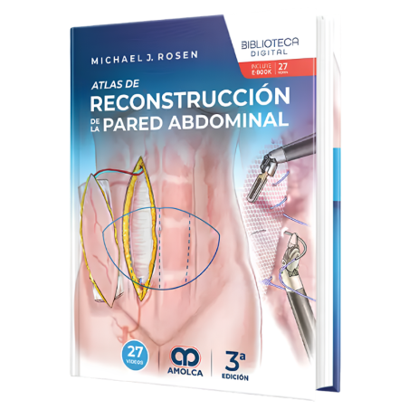 Atlas de reconstrucción de la pared abdominal