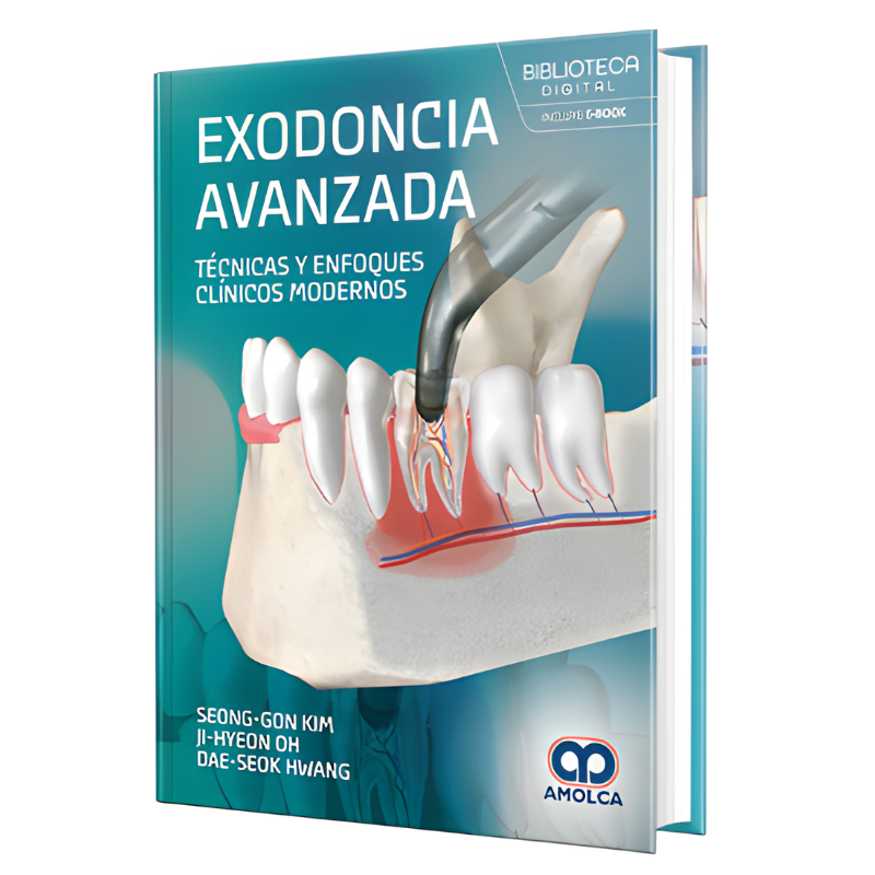 Exodoncia avanzada. Técnicas y enfoques clínicos modernos