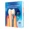 Planning of treatment in dental implantology