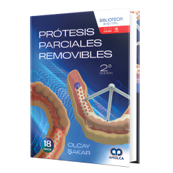 Removable partial prosthesis