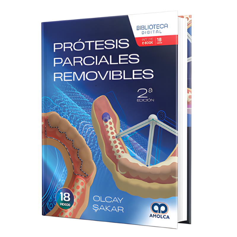 Prótesis parciales removibles