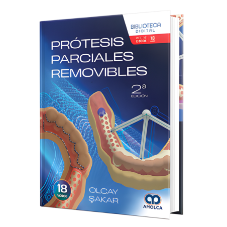 Prótesis parciales removibles