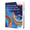 Removable partial prosthesis