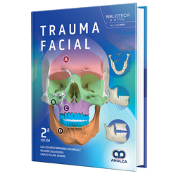 Facial trauma