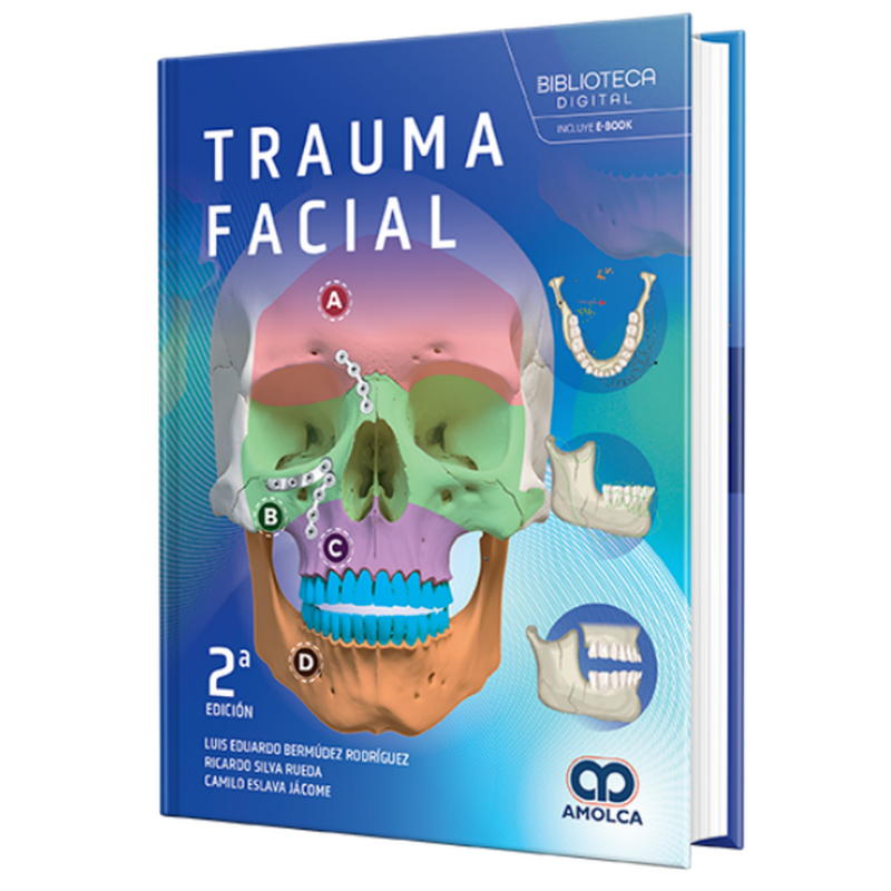 Facial trauma