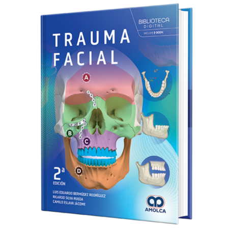 Facial trauma