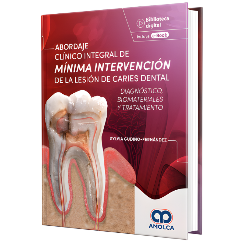 Abordaje Clínico Integral de Mínima Intervención de la Lesión de Caries Dental