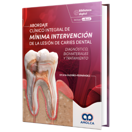 Integral clinical approach of minimal intervention of dental caries injury