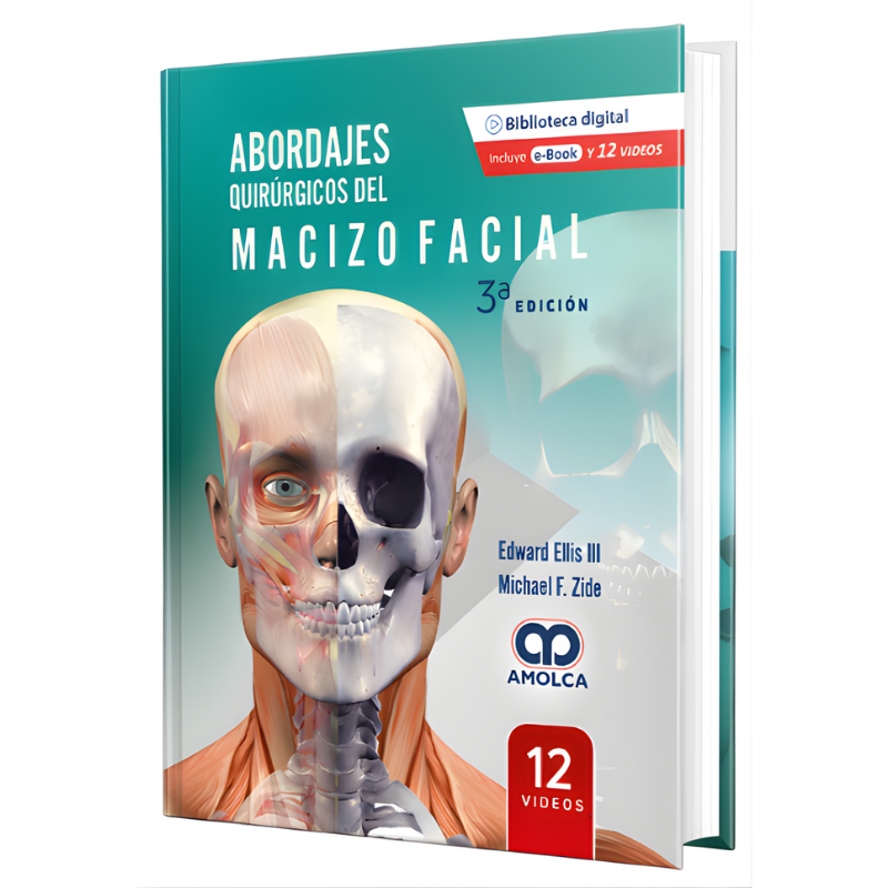 Surgical approaches of the facial massif. 3th Edition