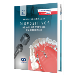 Dispositivos de Anclaje Temporal en Ortodoncia - 2ª Edición