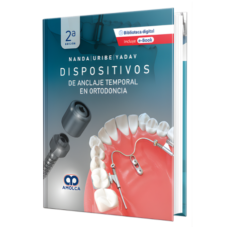 Temporary anchor devices in orthodontics - 2nd edition