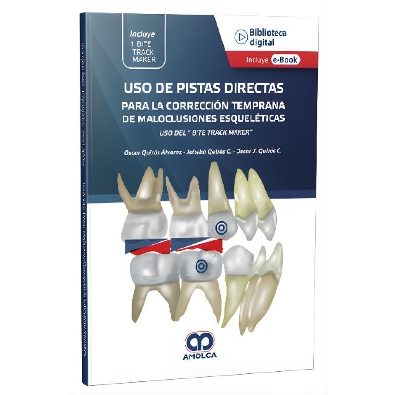 Uso de Pistas Directas para la corrección temprana de maloclusiones esqueléticas
