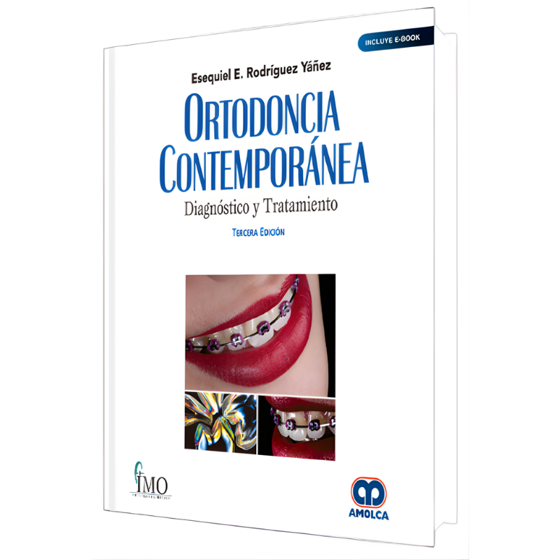 Ortodoncia Contemporánea. Diagnóstico y Tratamiento. 3 Edición