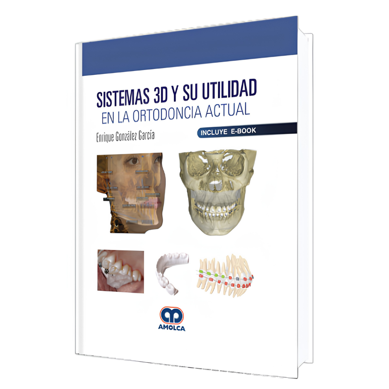Sistemas 3D y su Utilidad en la Ortodoncia Actual