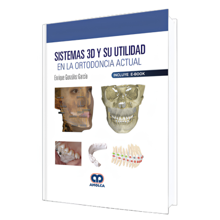 Sistemas 3D y su Utilidad en la Ortodoncia Actual