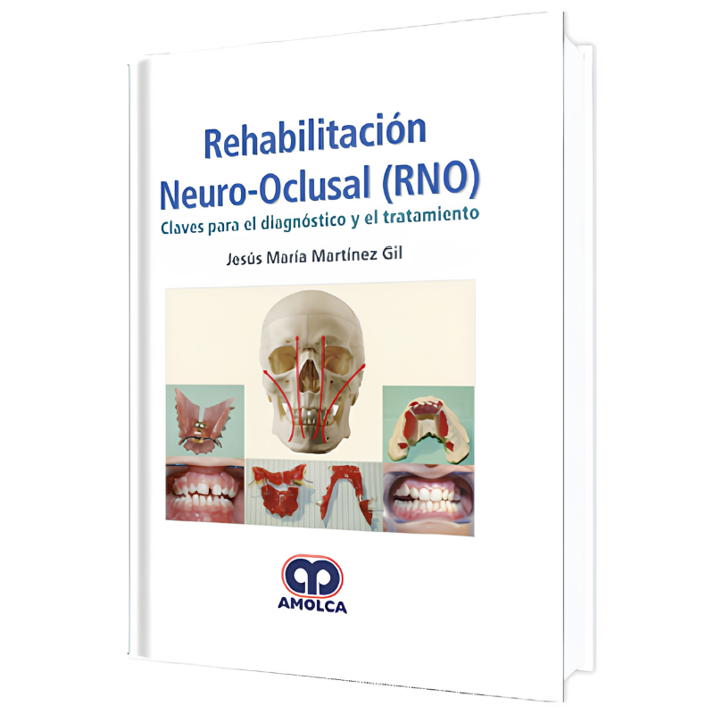 Neuro-occlusal rehabilitation (RNO)